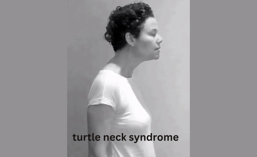 turtle neck syndrome massages